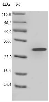 Lophura leucomelanos LYZ / Lysozyme Protein (Recombinant 6His-SUMO, N-terminus)