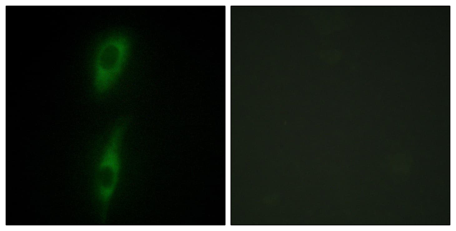 PathPlus™ ACVRL1 Antibody (aa196-245)