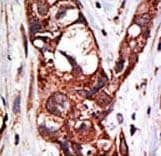 Polyclonal Rabbit anti-Human SAE1 Antibody (aa300-329, IHC, WB)