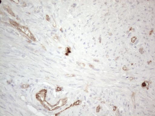 PROCR / EPCR Antibody (aa1-210, clone OTI12H5, Carrier-free)