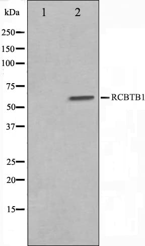 Polyclonal Rabbit anti-Human RCBTB1 Antibody (IHC, IF, WB)