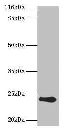 Recoverin Antibody (aa2-200)