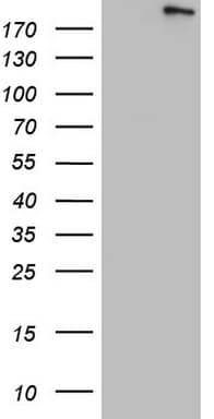 TOP2A / Topoisomerase II Alpha Antibody (aa1100-1531, clone OTI10G1)