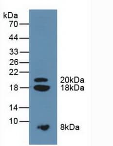 SPINK1 Antibody (aa26-78)