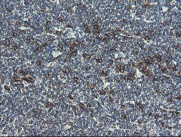 UBE2J1 Antibody (clone OTI1F6)