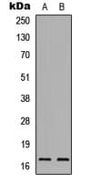 IL36RN / IL1F5 Antibody (Internal)