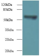 TCP11L2 Antibody
