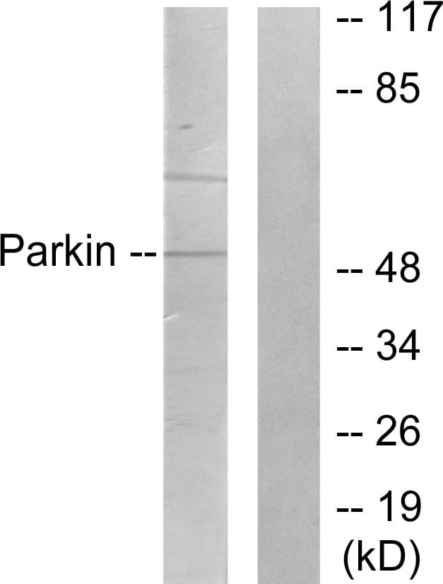 PathPlus™ PARK2 / Parkin 2 Antibody (aa1-50)