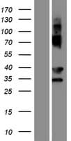 EVPLL Protein (Over-Expression Lysate Myc-DDK (Flag))