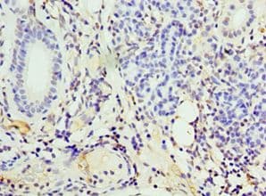 CD119 / IFNGR1 Antibody (aa270-489)