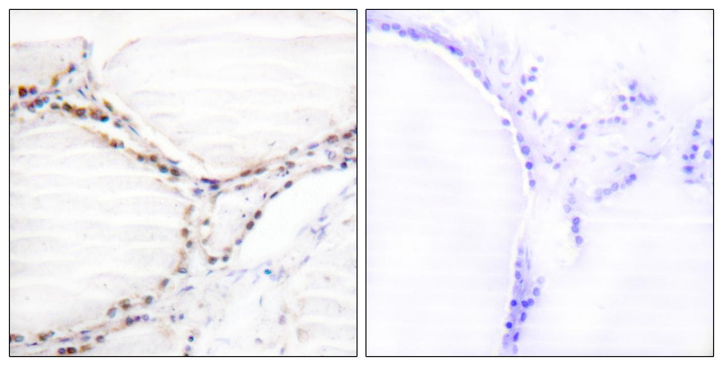 Vitamin D Receptor / VDR Antibody (p208)
