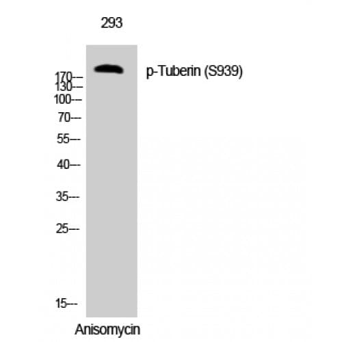 Tuberin / TSC2 Antibody (880-960 aa)