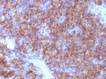 CHGA / Chromogranin A Antibody (clone CHGA/798)