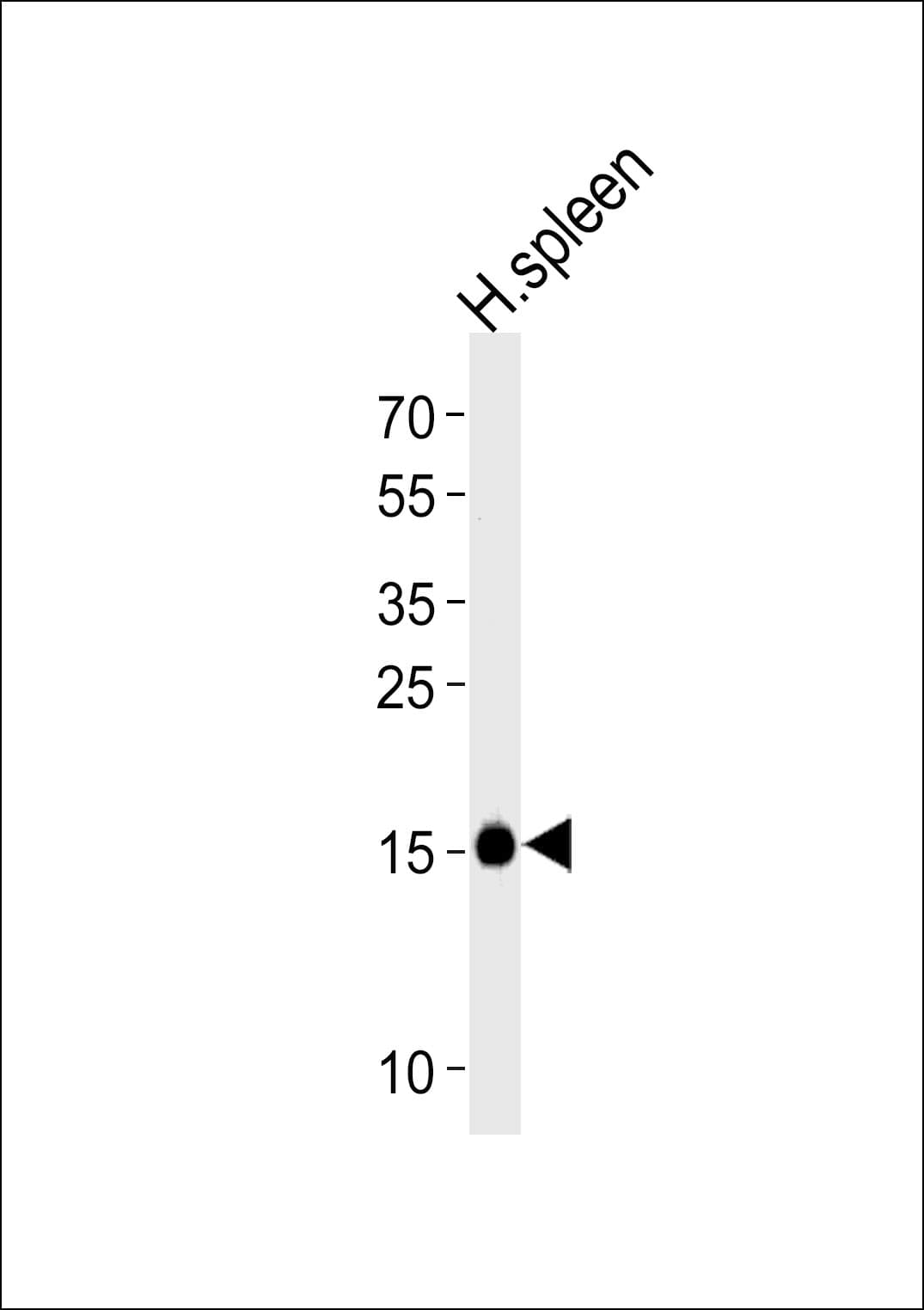 Polyclonal Rabbit anti-Human RNASE2 / EDN Antibody (aa124-152, WB)