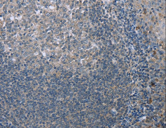 Polyclonal Rabbit anti-Human FAR2 Antibody (IHC)