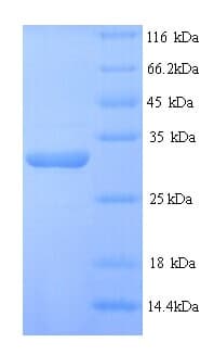 Human DSP / Desmoplakin Protein (Recombinant His)