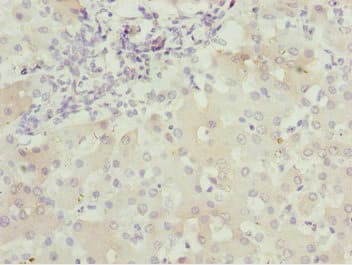 Polyclonal Rabbit anti-Human BNIP1 Antibody (IHC)