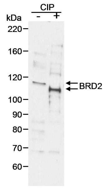 BRD2 / RING3 Antibody (aa550-600)