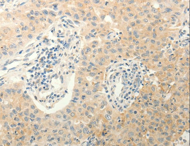 Polyclonal Rabbit anti-Human ERG Antibody (IHC, WB)