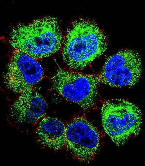 GTF2H2C Antibody (aa314-343)