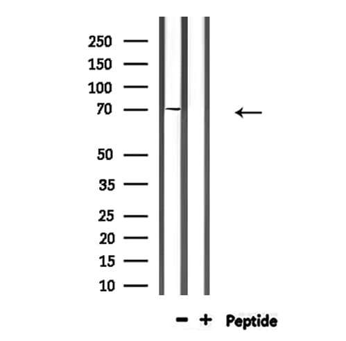 GARS / Glycyl tRNA Synthetase Antibody
