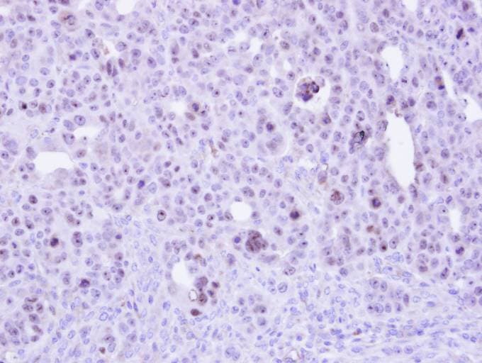 Polyclonal Rabbit anti-Human ZC3H8 Antibody (aa31-291, IHC, WB)