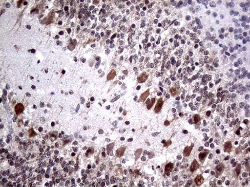 NPAS1 Antibody (aa319-522, clone OTI4C10, Carrier-free)