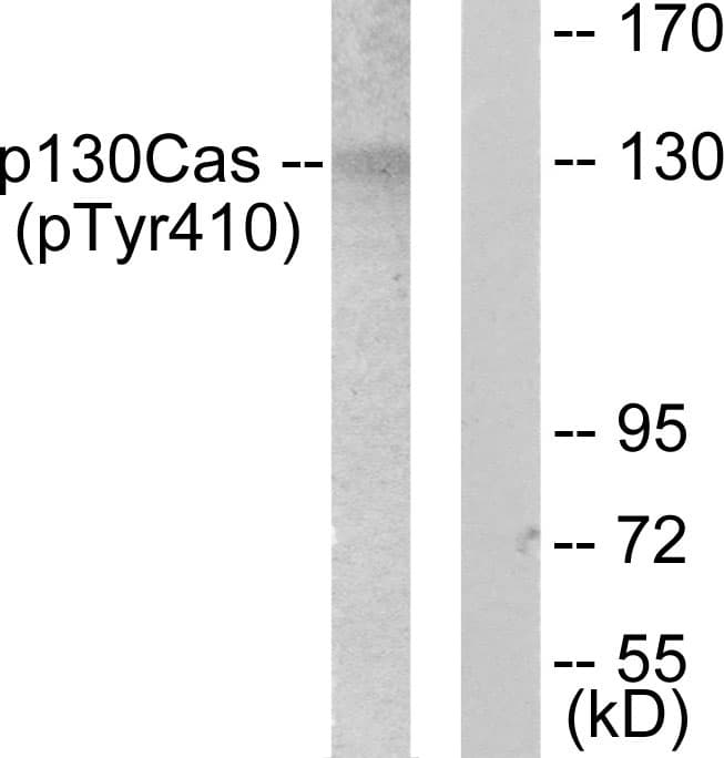 Polyclonal Rabbit anti-Human BCAR1 / p130Cas Antibody (phospho-Tyr410, IHC, WB)