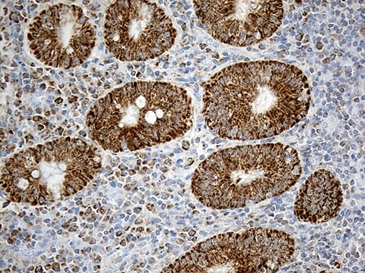 Monoclonal Mouse anti-Human CHCHD10 Antibody (clone OTI2B6, aa17-142, IHC, WB)