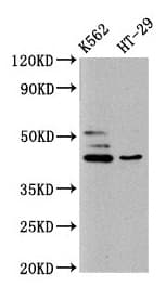 Polyclonal Rabbit anti-Human B3GNT6 Antibody (IHC, WB)
