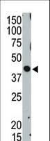 TSG101 Antibody (aa340-370)