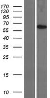 TMEM209 Protein (Over-Expression Lysate Myc-DDK (Flag))