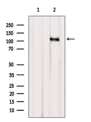 Polyclonal Rabbit anti-Human CASC3 / MLN51 Antibody (WB)