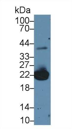 PRDX1 / Peroxiredoxin 1 Antibody (aa1-199)