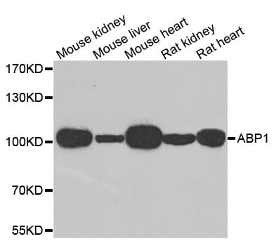 IHC-plus™ AOC1 Antibody