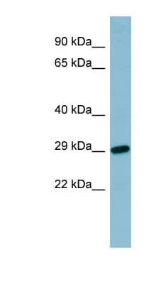 RBP4 Antibody (N-Terminus)