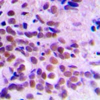 CDK1 / CDC2 Antibody (Internal)