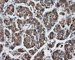 APP / Beta Amyloid Precursor Antibody (clone OTI2B10)