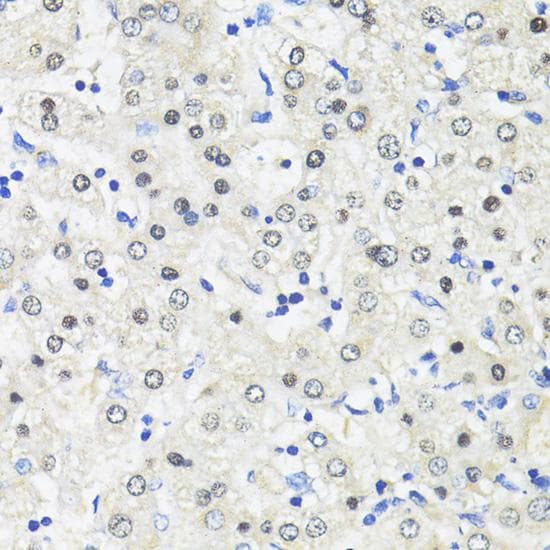 TRIM27 Antibody