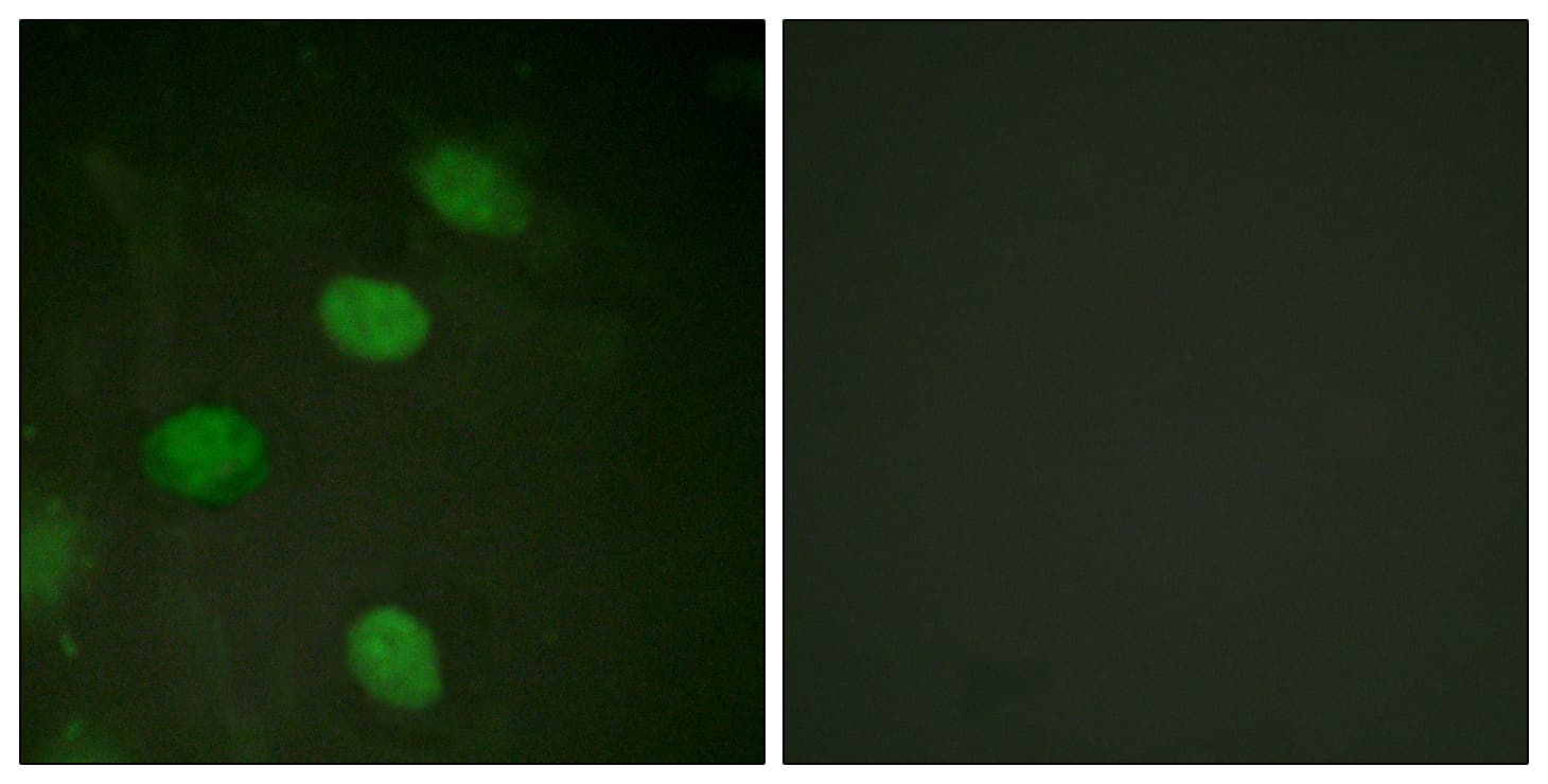Polyclonal Rabbit anti-Human JUN / c-Jun Antibody (phospho-Thr231, IHC, IF)