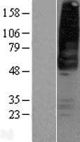 GPR42 Protein (Over-Expression Lysate Myc-DDK (Flag))