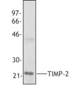 PathPlus™ TIMP2 Antibody (clone F27P3A4)
