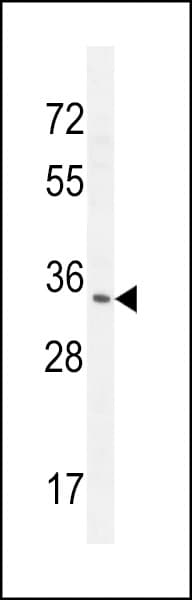 RNASET2 Antibody (aa10-36)