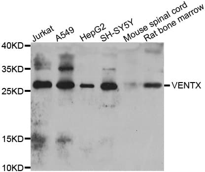 Polyclonal Rabbit anti-Human VENTX Antibody (IHC, WB)