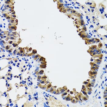 Esterase D / ESD Antibody