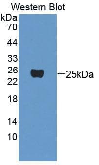 MEF2A / MEF2 Antibody (aa1-160, PE)