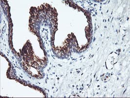 SQSTM1 Antibody (clone OTI5D5)