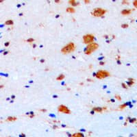 CDKN1B / p27 Kip1 Antibody (C-Terminus)