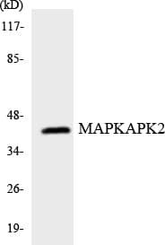 Polyclonal Rabbit anti-Human MAPKAPK2 / MAPKAP Kinase 2 Antibody (aa169-218, IHC, WB)