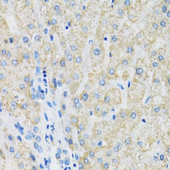 Polyclonal Rabbit anti-Human SLC19A1 Antibody (IHC, WB)